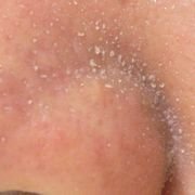 「世界から鏡が消えない限り」終わらない！　毛穴イジリは禁断の悦び、「毛穴と女」座談会 【後編】