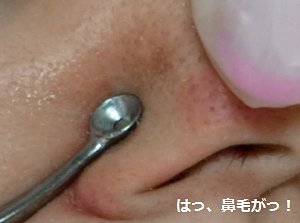 【画像アリ】鼻毛穴の「角栓」と全面闘争！　毛穴の“黒ずみ”に燃える女の狂熱ルポ
