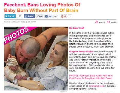 Facebookが大病を患う赤ん坊の写真を「不適切」と削除し、非難される