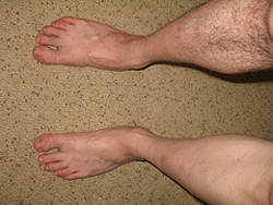 脱毛なんて片手間でよし！　時間も自由も奪わない、とにかくラクな方法は？