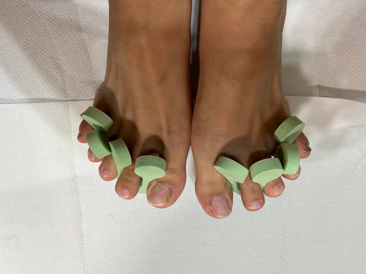 セパレーターをはめてジェルネイルの準備が完了した画像