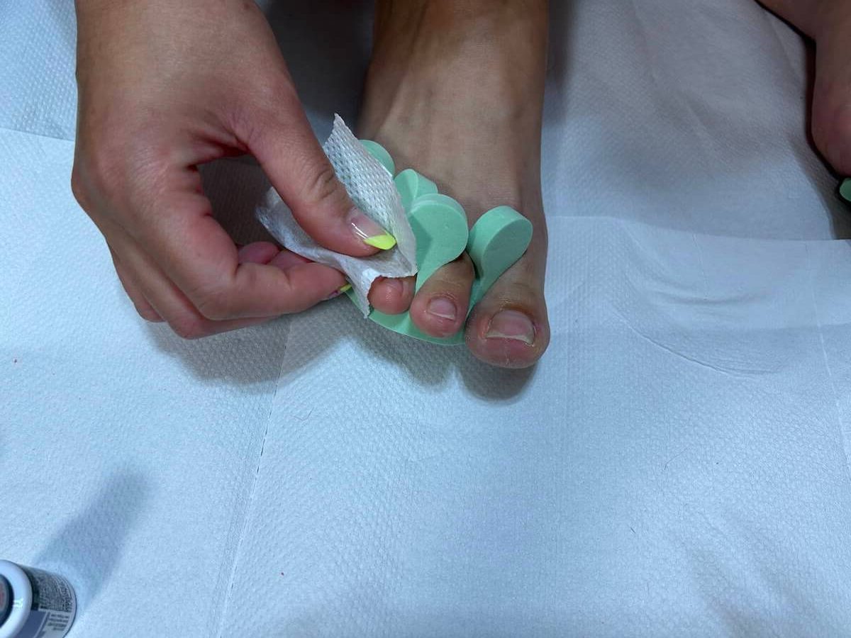 エタノールを含ませたキッチンペーパーで爪表面の油分・水分除去する画像