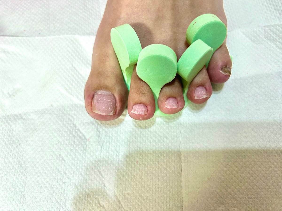 爪表面の甘皮処理後の画像