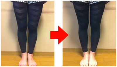 露出度の高いファッションを楽しみたい！　かなわぬ夢をかなえてくれる下半身ヤセの原理