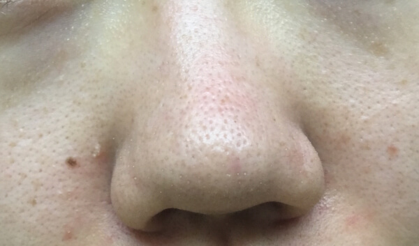 これでも毛穴ケアめっちゃしてます！（C）サイゾーウーマン